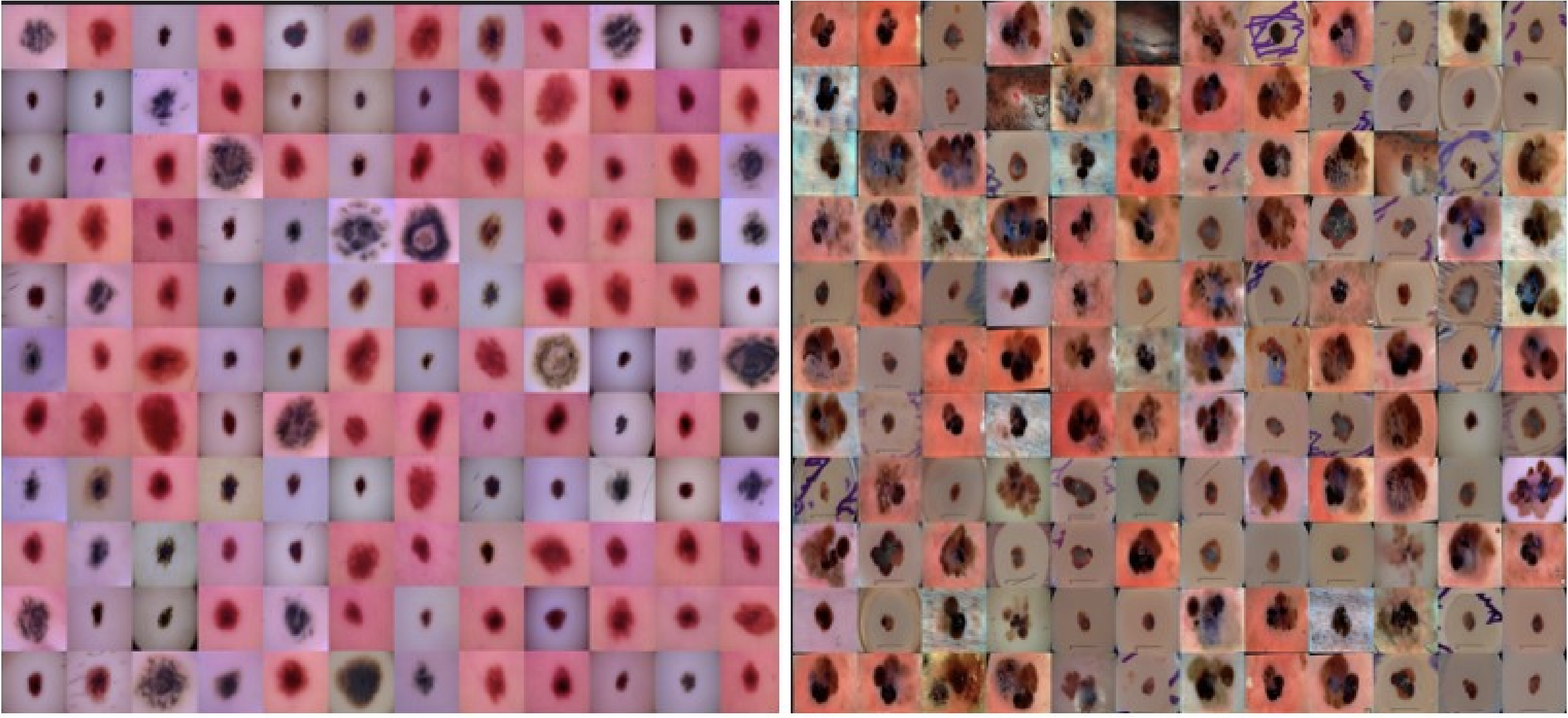 Derm-T2IM: Harnessing Synthetic Skin Lesion Data via Stable Diffusion Models for Enhanced Skin Disease Classification using ViT and CNN