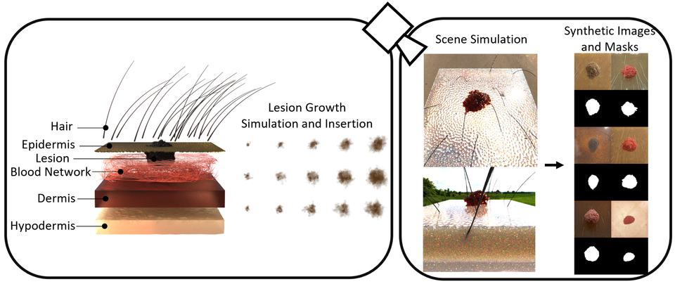 S-SYNTH : Knowledge-based synthetic generation of skin images