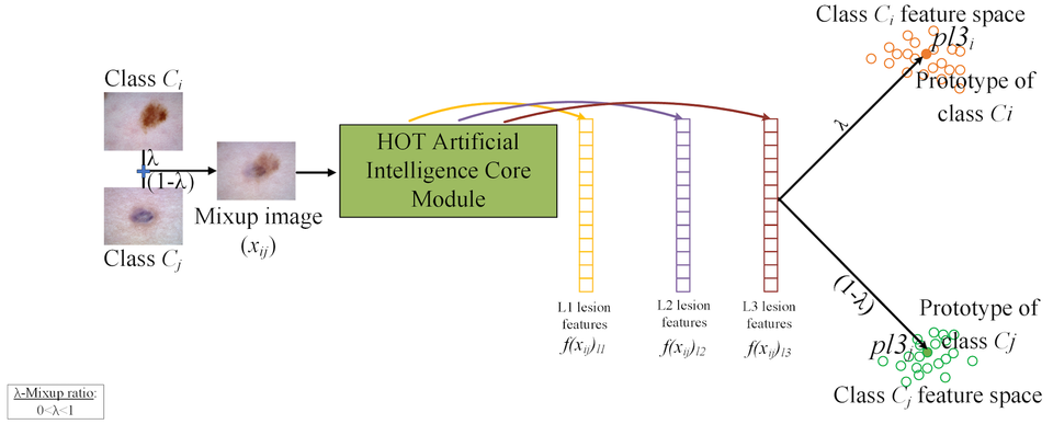 Breaking New Ground in Dermatology: How Multi-Task AI is Transforming Skin Lesion Diagnosis